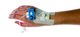 Design Bugs Out: Cannula with Self-timing Indicator