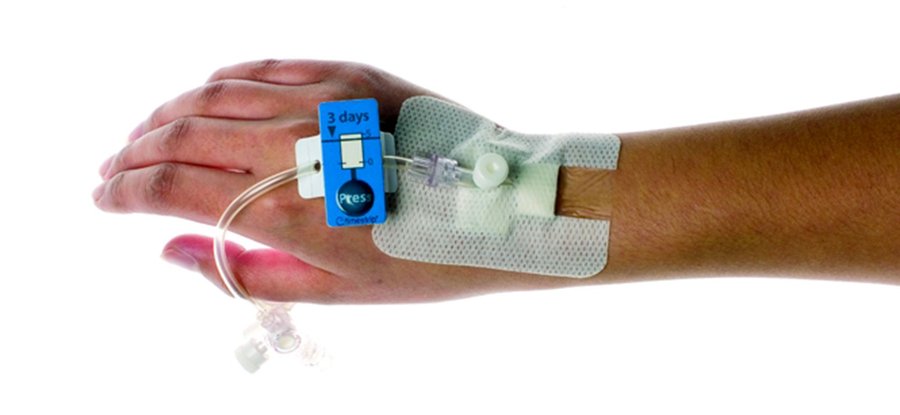 Design Bugs Out: Cannula with Self-timing Indicator